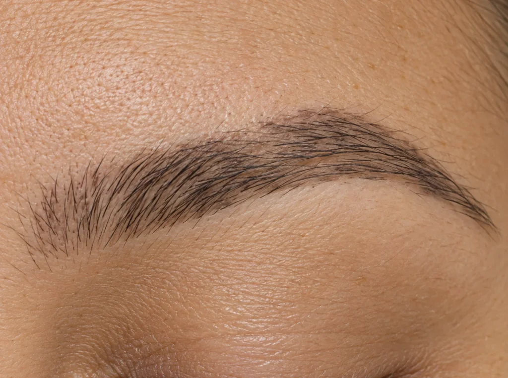 Illustration of a healing eyebrow that looks lighter and uneven in places.